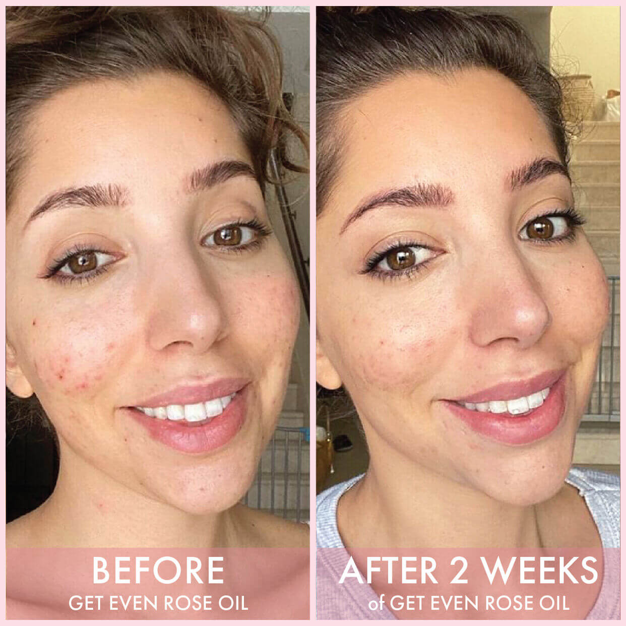 image showing pakistani girl after using huda beauty wishful get even rose oil for dark circles available at heygirl.pk in Pakistan