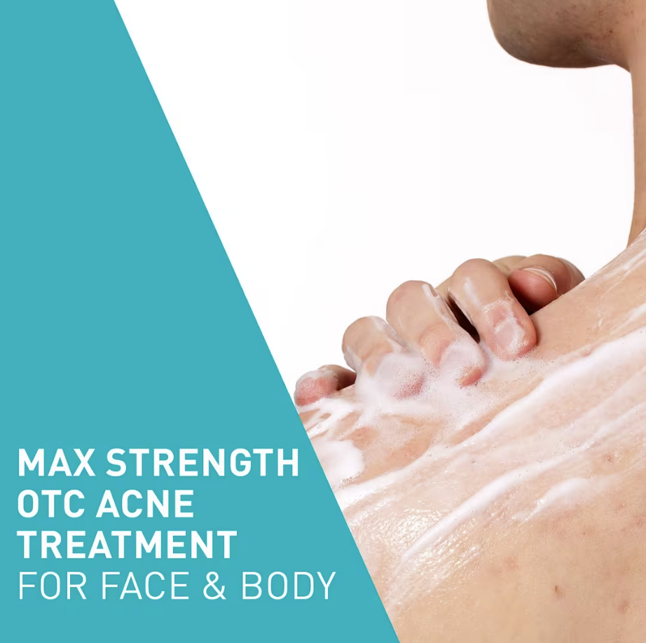 image showing benefits of using CeraVe Acne Foaming Cream Wash for acne and pimples available in Pakistan