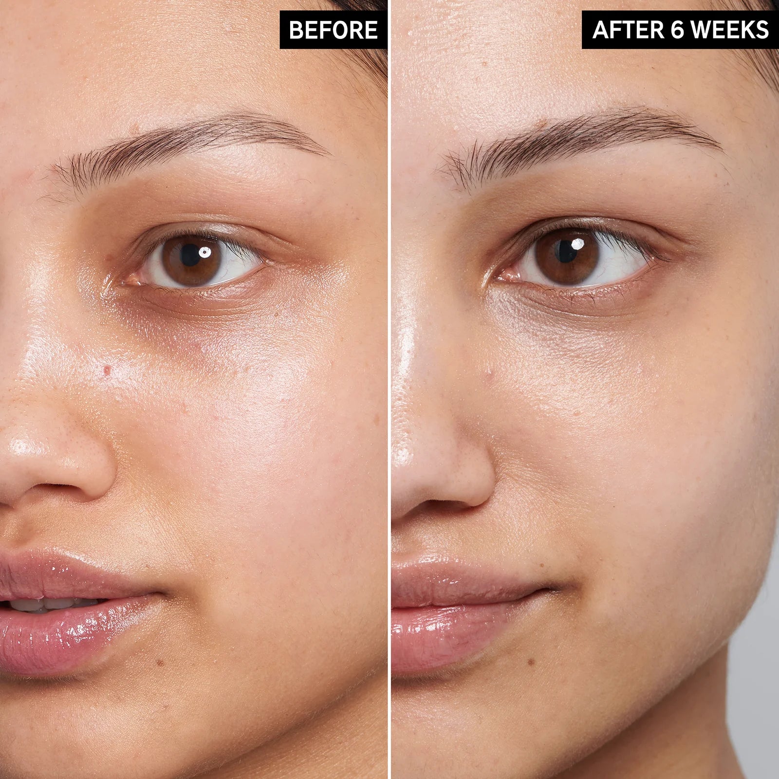 image showing before and after of using caffeine solution for eye dark circles available at Heygirl.pk for delivery in Pakistan