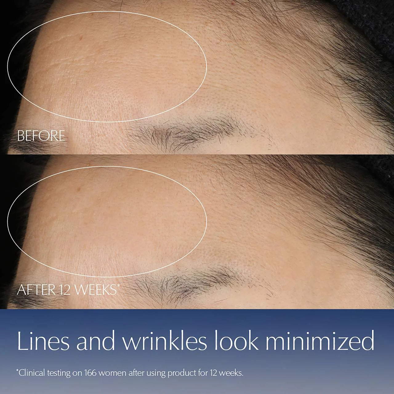 image showing benefits of using Estee Lauder Advanced Night Repair Serum to reduce fine lines, wrinkles, clogged pores and signs of aging available for delivery in Pakistan.