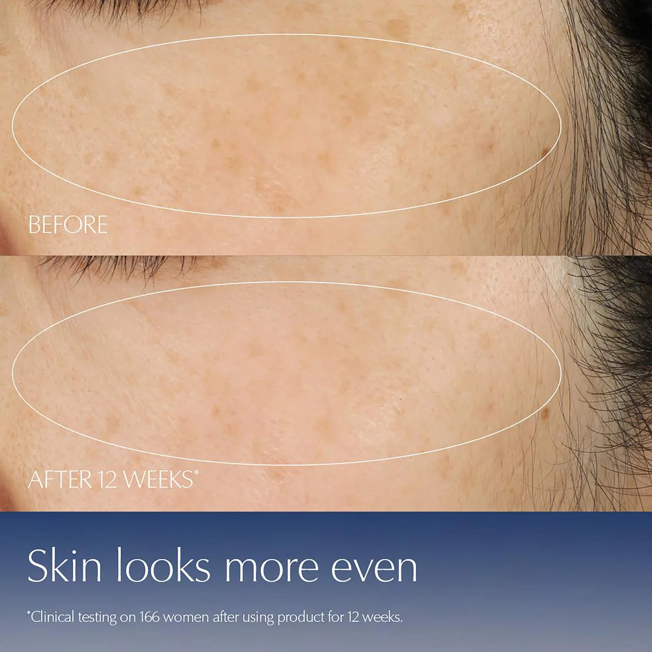 image showing benefits of using Estee Lauder Advanced Night Repair Serum to reduce fine lines, wrinkles, clogged pores and signs of aging available for delivery in Pakistan.