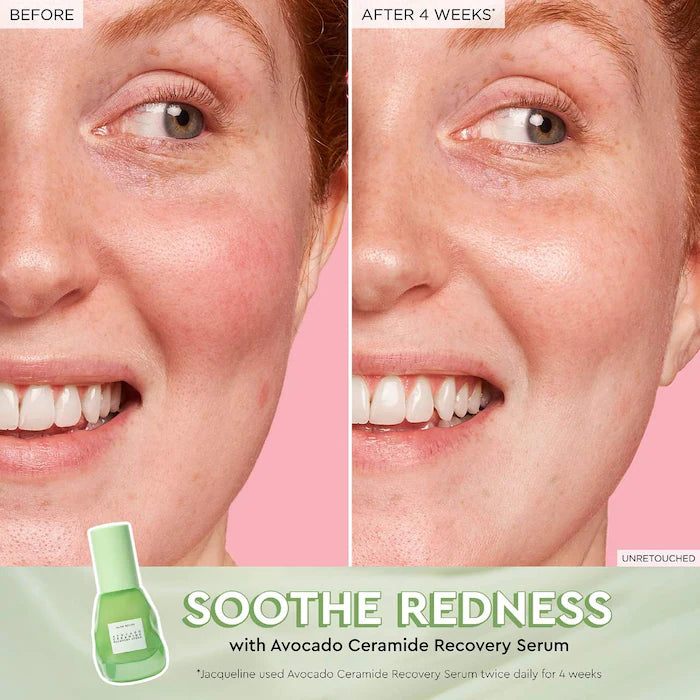 image showing before and after result of using glow recipe avocado recovery serum available at Heygirl.pk for delivery in Pakistan