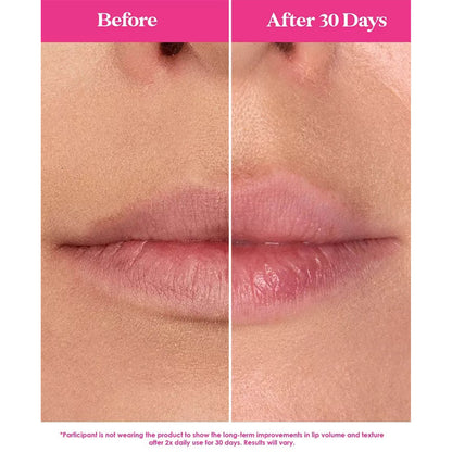 before and after results of using grande lip plumper for her available at Heygirl.pk for delivery in Pakistan