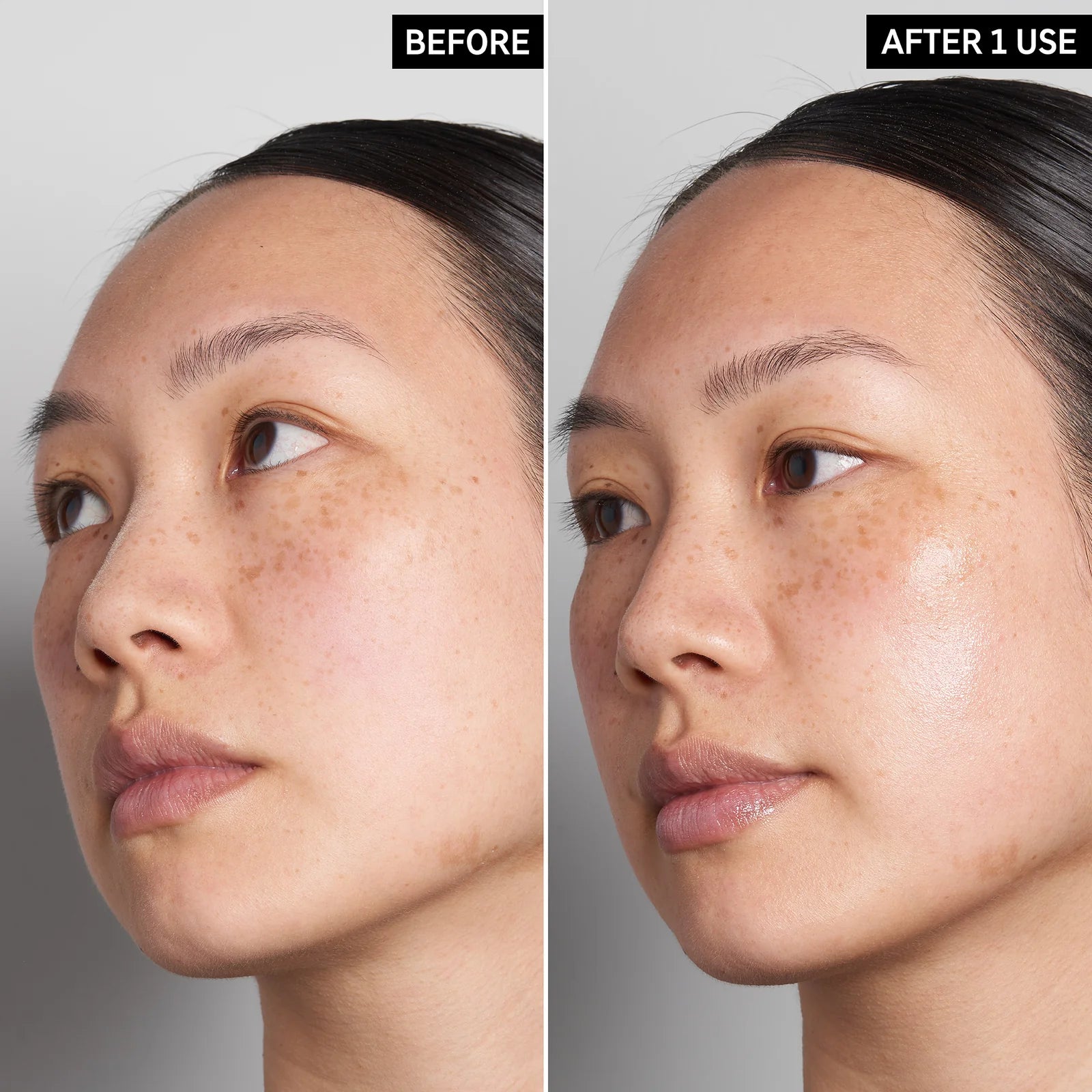 image showing before and after results of using inkey hyaluronic acid serum available at Heygirl.pk for delivery in Pakistan