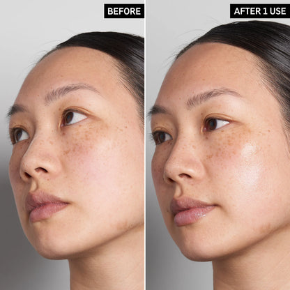 image showing before and after results of using inkey hyaluronic acid serum available at Heygirl.pk for delivery in Pakistan