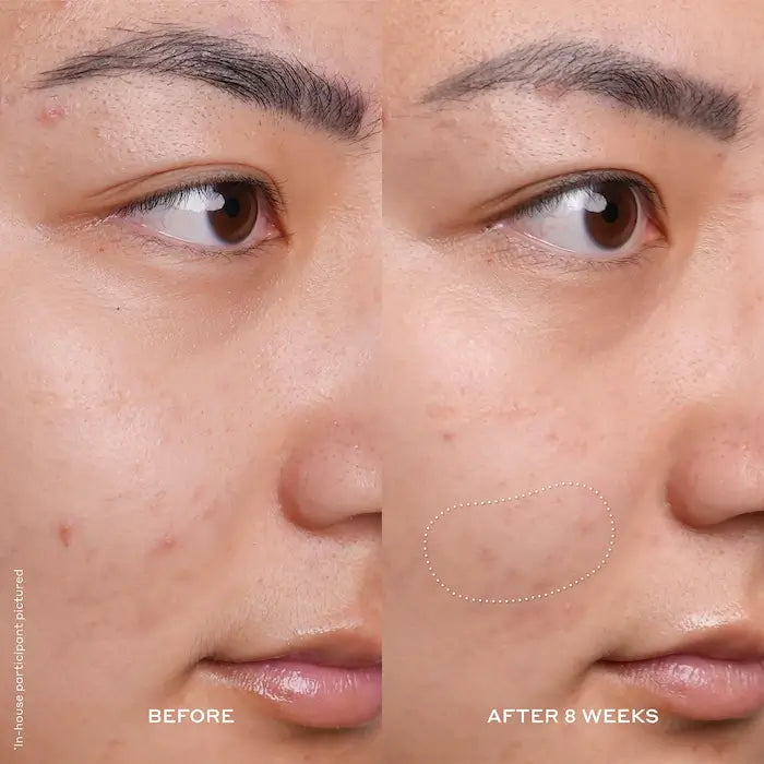 image showing before and after results of using Olehenriksen Bright Vitamin C Dark Spot Serum for skin brightness available at Heygirl.pk for delivery in Pakistan