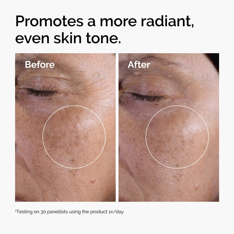 image showing benefit of using The Ordinary Glycolic Acid Duo Value Set for skin brightening available at Heygirl.pk for delivery in Pakistan