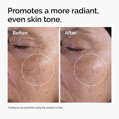 image showing benefit of using The Ordinary Glycolic Acid Duo Value Set for skin brightening available at Heygirl.pk for delivery in Pakistan