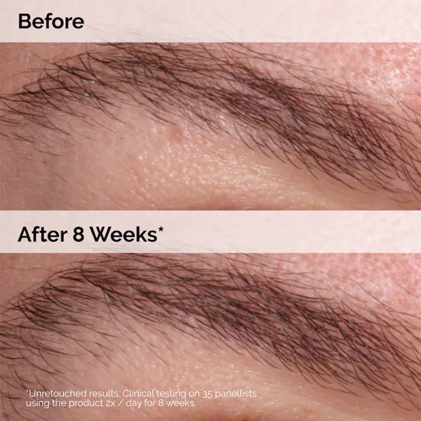image showing benefits of using The Ordinary Multi Peptide Lash and Brow Serum available at Heygirl.pk for delivery in Pakistan
