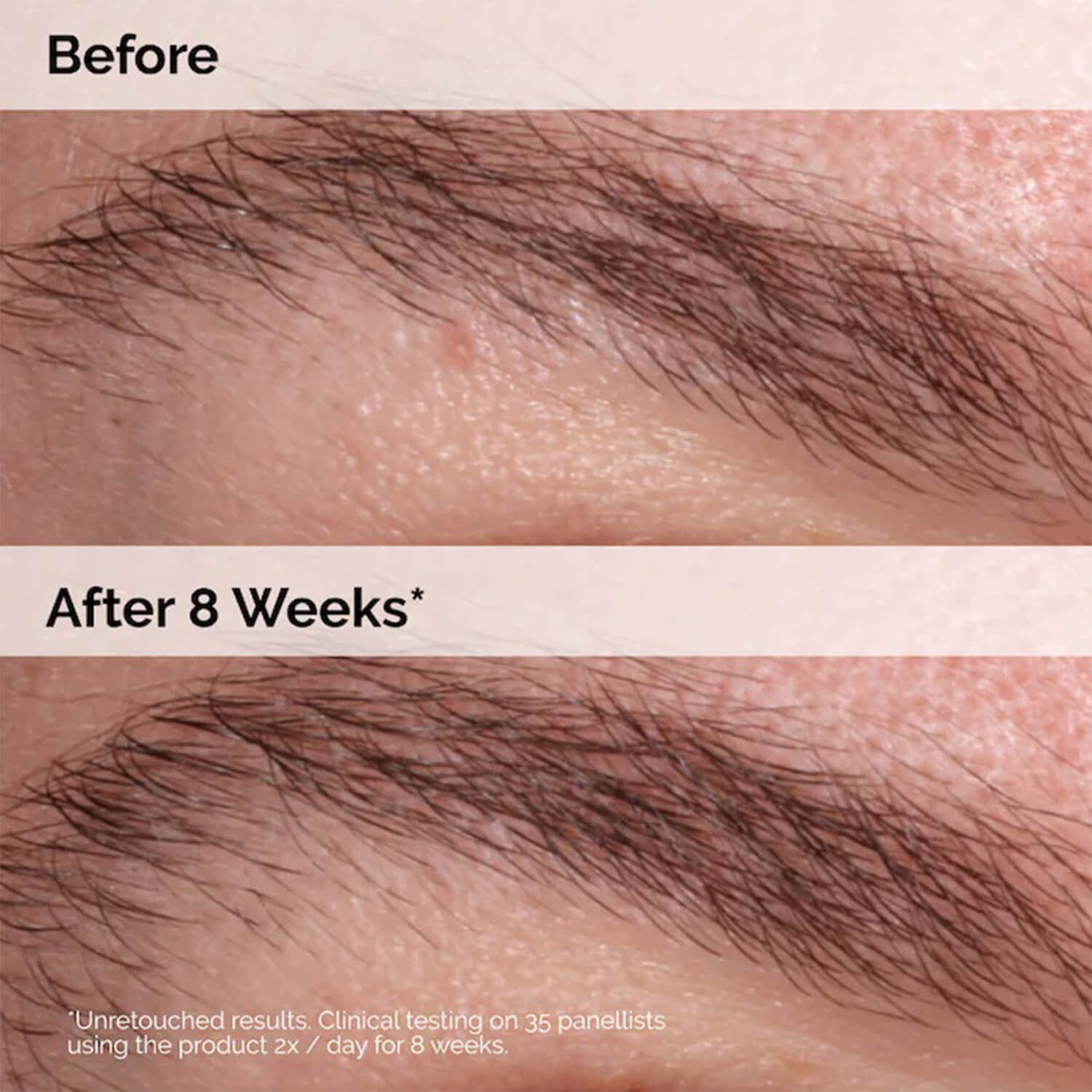 image showing benefits of using The Ordinary Multi Peptide Lash and Brow Serum available at Heygirl.pk for delivery in Pakistan