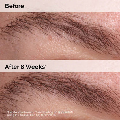 image showing benefits of using The Ordinary Multi Peptide Lash and Brow Serum available at Heygirl.pk for delivery in Pakistan