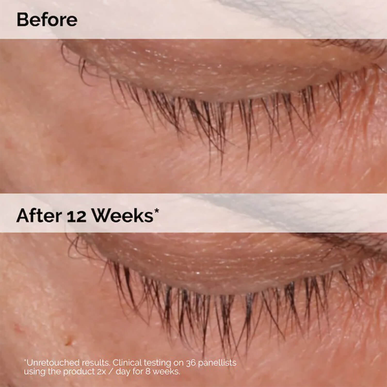 image showing benefits of using The Ordinary Multi Peptide Lash and Brow Serum available at Heygirl.pk for delivery in Pakistan