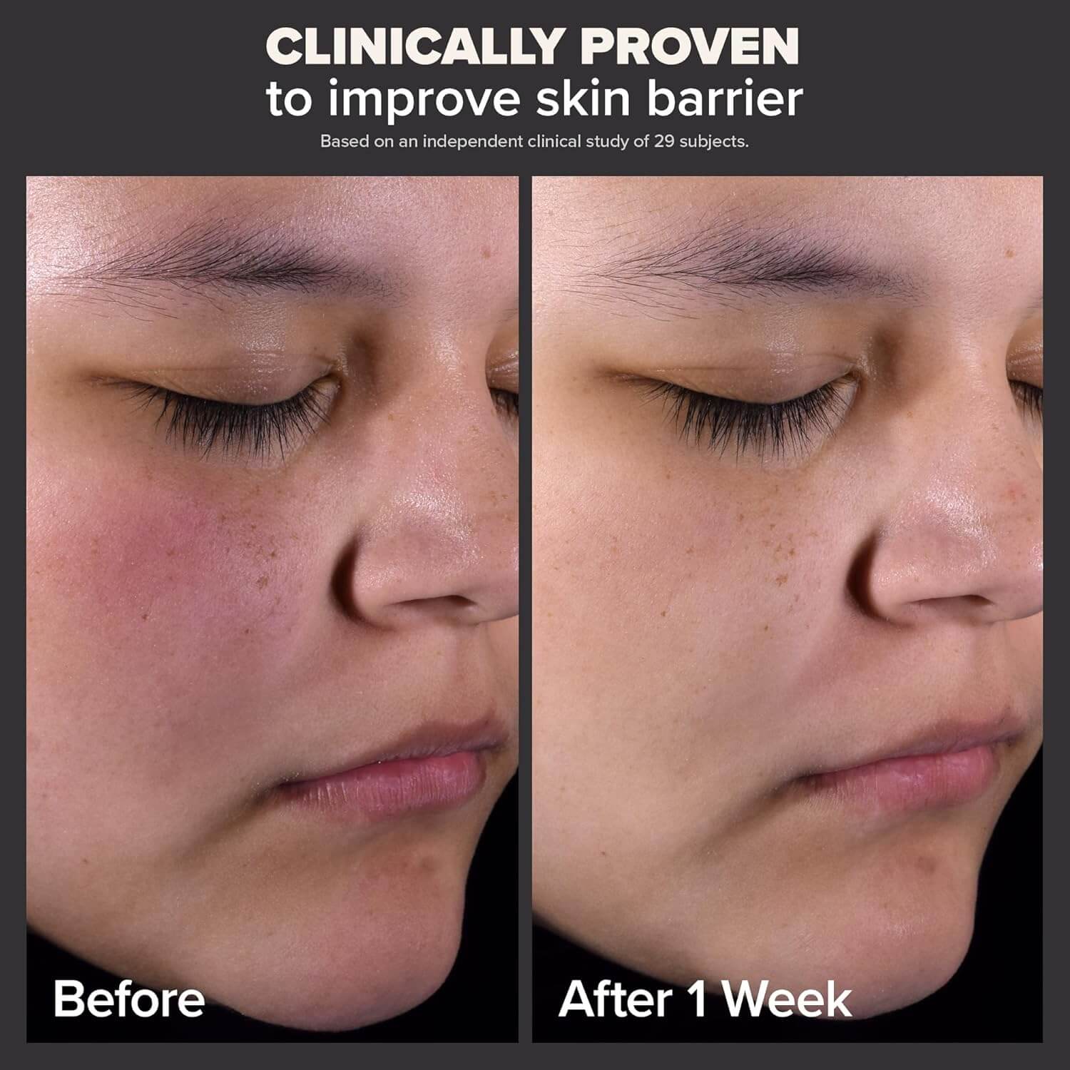 image showing before and after of using Paula's Choice 2% BHA Liquid Exfoliant for enlarged pores and uneven skin tone available for delivery in Karachi, Lahore, Islamabad across Pakistan
