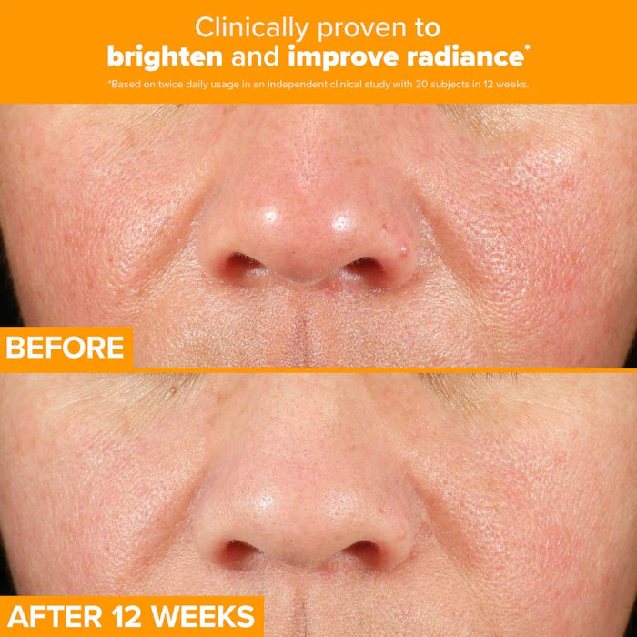 image showing benefits of using Paula's Choice Paula's Choice Vitamin C Booster for skin glow and brightening available at Heygirl.pk for delivery in Pakistan.