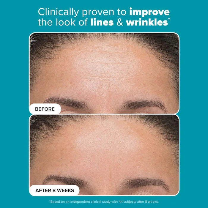 image showing before and after result of using Paula's Choice Mandelic and Lactic Acid for skin brightening and reducing fine lines and wrinkles available at Heygirl.pk for delivery in Pakistan.