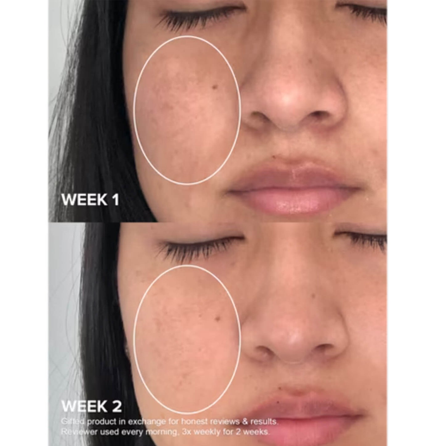 image showing benefits of using Paula's Choice Niacinamide for dark spots and clogged pores available at Heygirl.pk for delivery in Pakistan