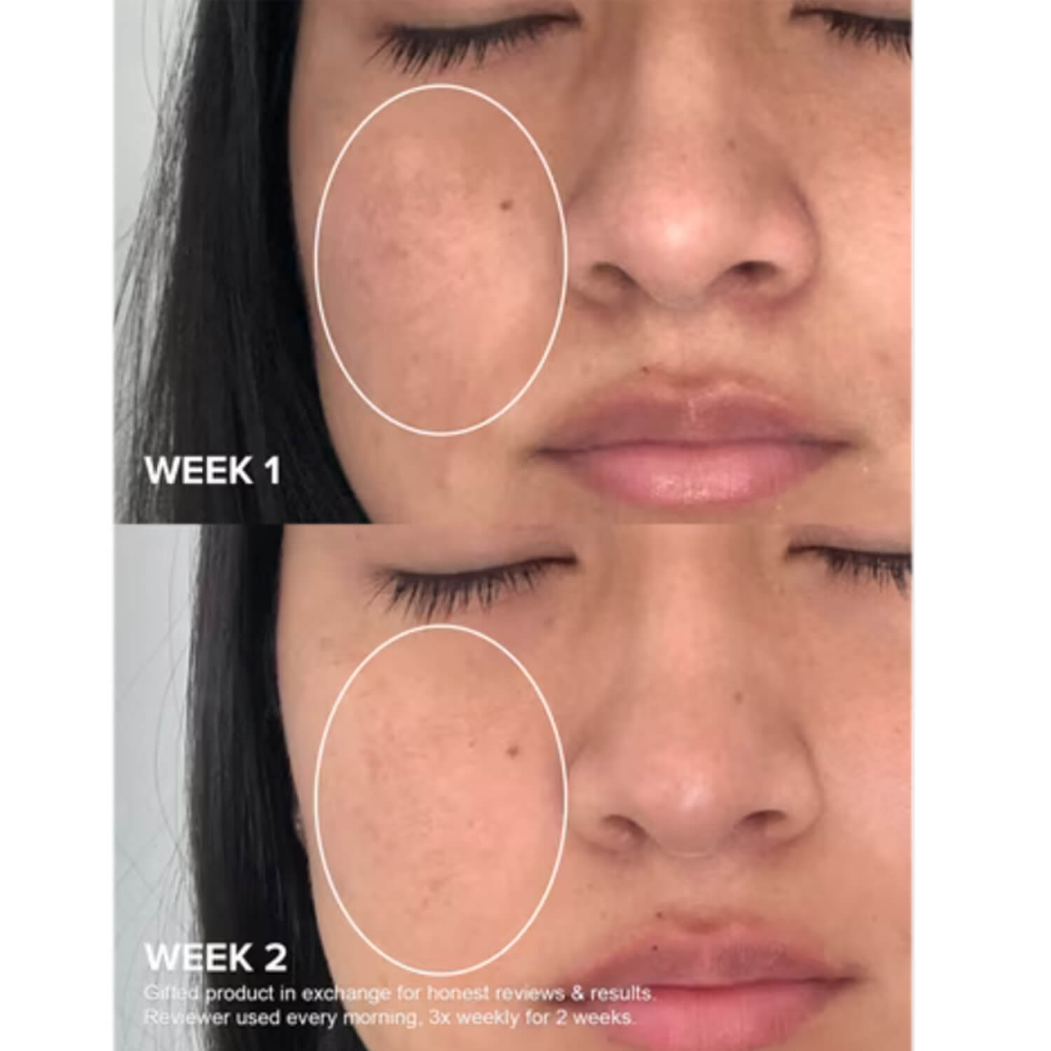 image showing benefits of using Paula's Choice Niacinamide for dark spots and clogged pores available at Heygirl.pk for delivery in Pakistan