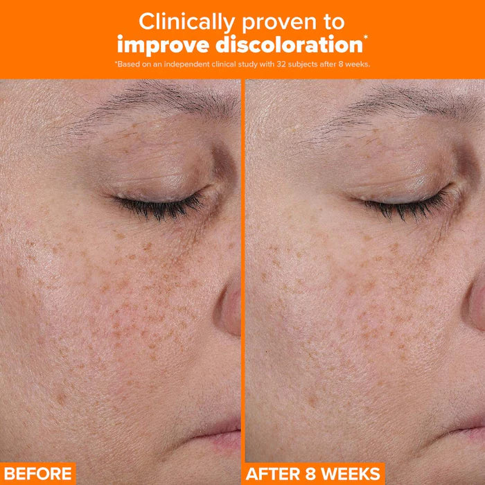 image showing benefits of using Paula's Choice 25% Vitamin C + Glutathione Clinical Serum for skin brightening available at Heygirl.pk for delivery in Pakistan.