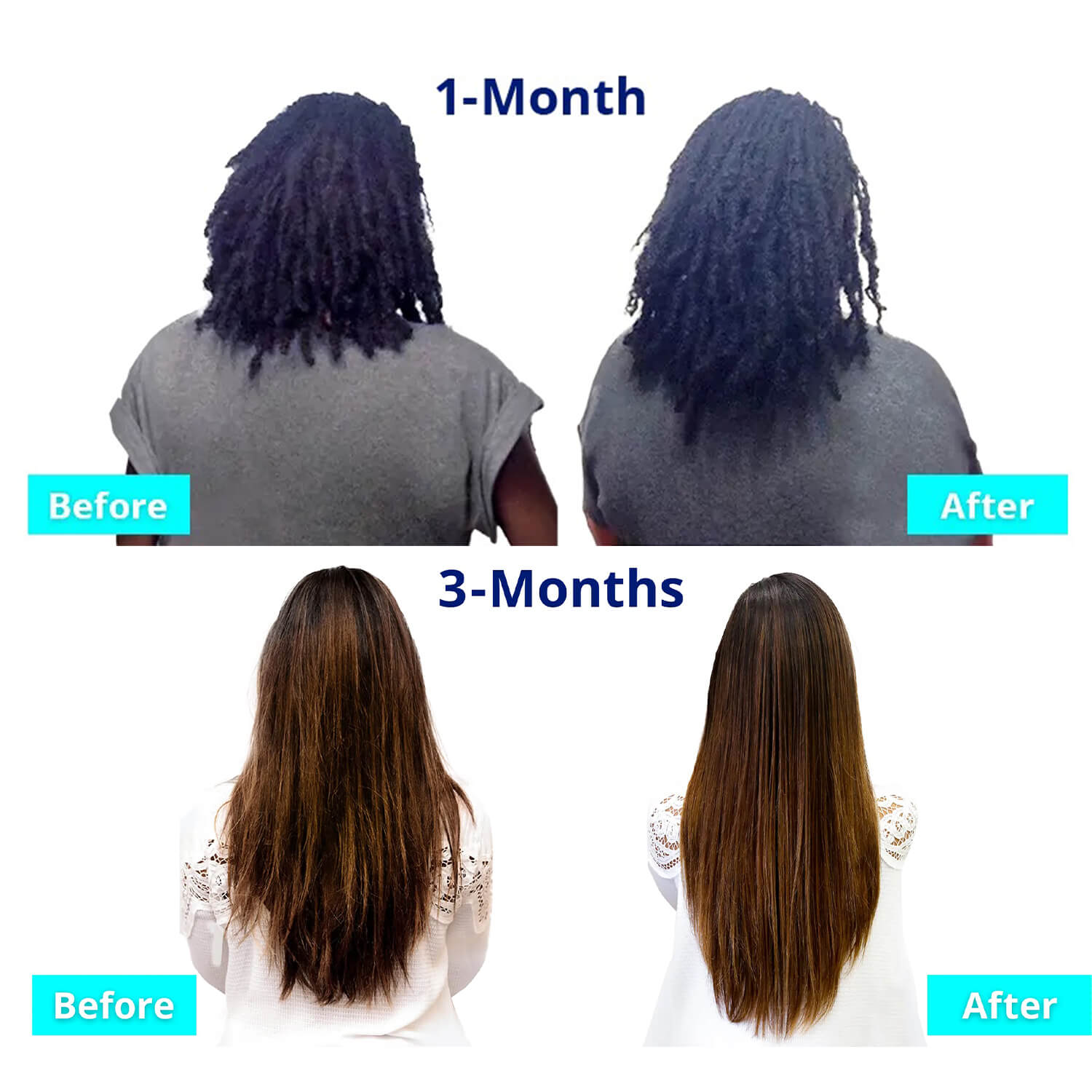 image showing benefits of using SugarBearPRO Hair Vitamin Halal Gummiesfor longer hair available at Heygirl.pk for delivery in Pakistan