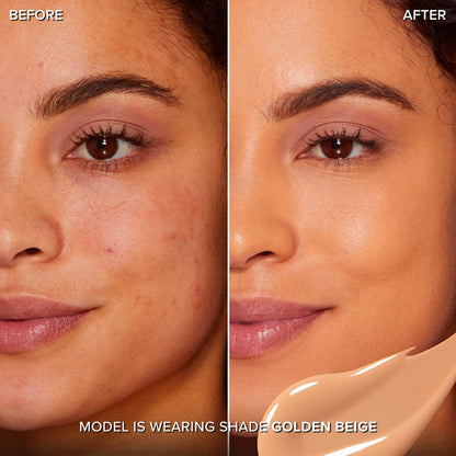 Before and after comparison of a model wearing Too Faced Born This Way Super Coverage Concealer golden beige shade available at Heygirl.pk for delivery in Pakistan